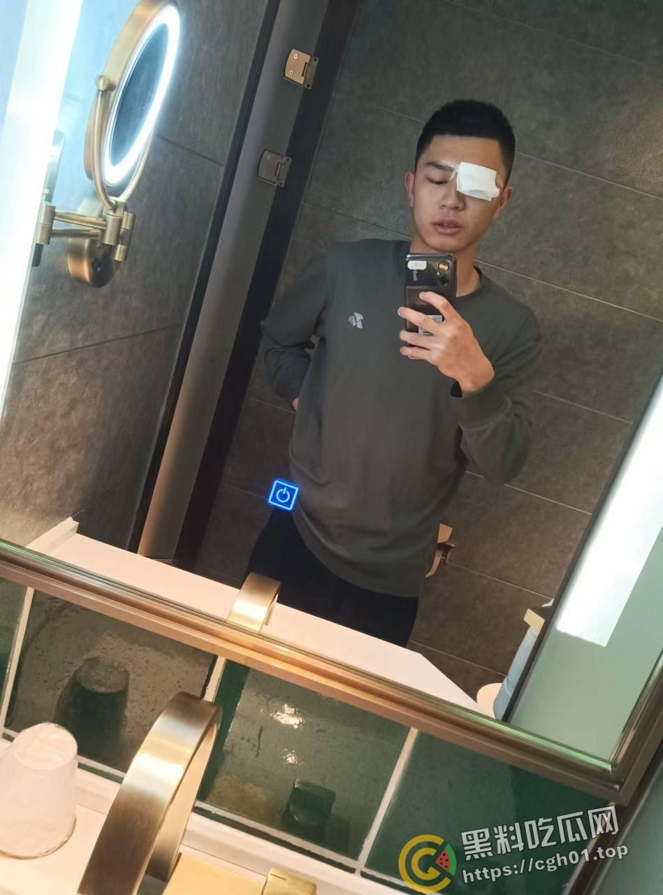 蚌埠大学生为参军做飞秒手术 在部队内遭感染被丢回家 最终不治身亡 家人抖音喊冤被封-5